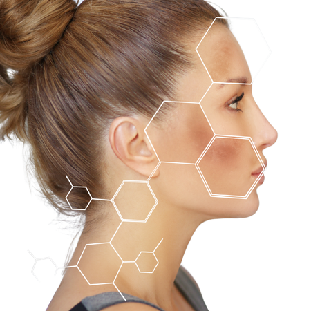 IPL helps to treat conditions like hyper pigmentation melasma vascularity and rosacea